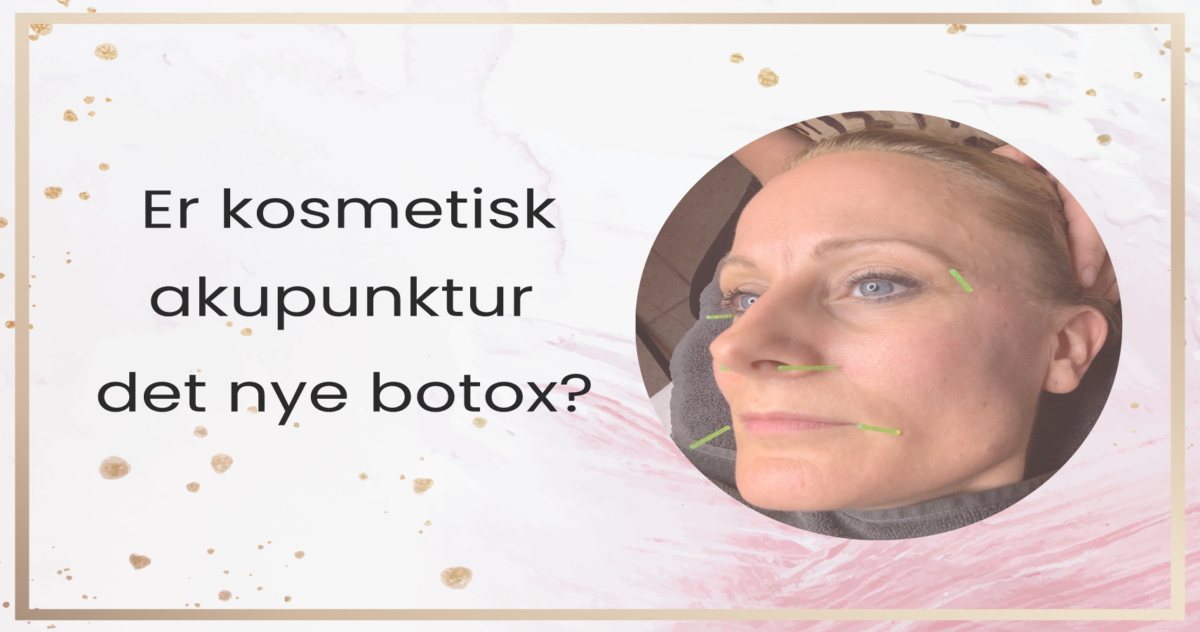 kosmetisk-akupunktur-cover